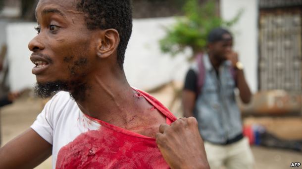 A man shows his injuries on September 20, 2016, near the offices of the main opposition party, Union for Democracy and Social Progress in the Democratic Republic of Congo.